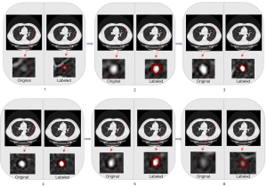 A lightweight neural network for lung nodule detection based