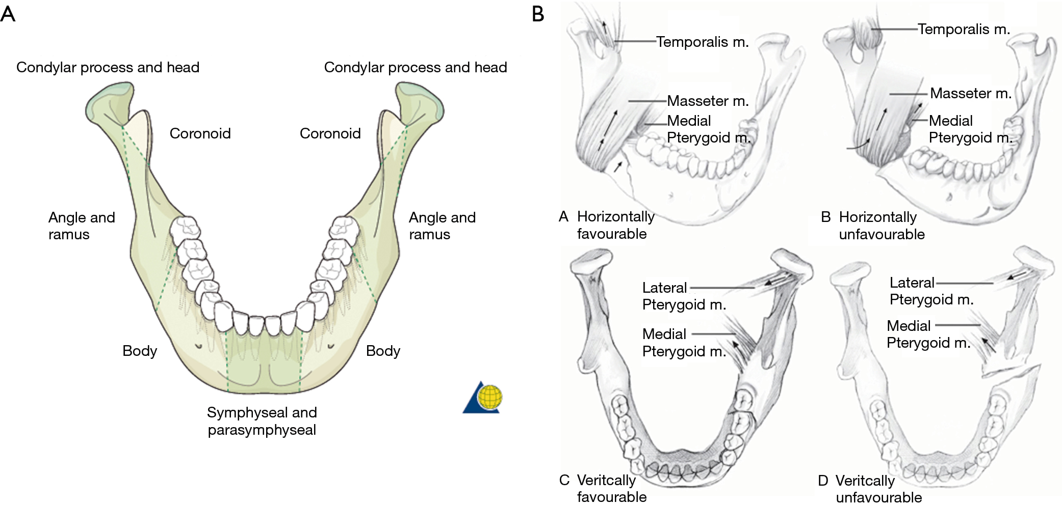 The Classification Of Mandibular Condyle Fracture Acc - vrogue.co