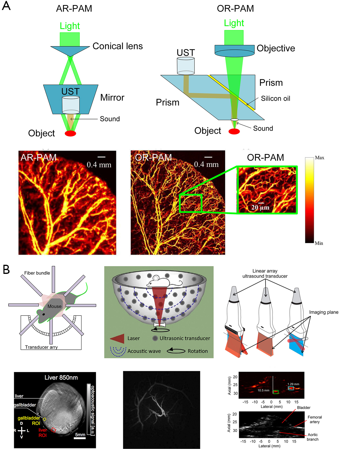 photoacoustic imaging as a highly