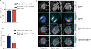 Three-dimensional quantitative assessment of myocardial