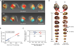 Three-dimensional quantitative assessment of myocardial