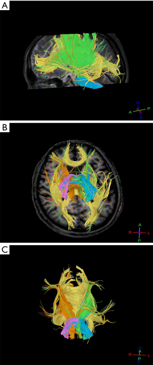 エト Adidas Original ZX 1K BOOST - SEASONALITY Men's - BLACK/GREY
