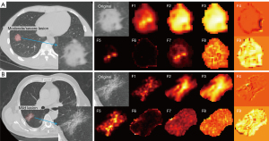 Wavelet transformation can enhance computed tomography