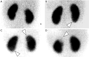 Semiquantitative analysis of power doppler ultrasonography versus Tc ...