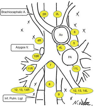 Mediastinal Lymph Node Staging For Lung Cancer Sawabata Mediastinum