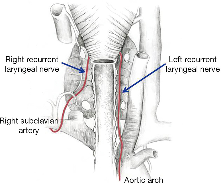 The Evolution And Progress Of Mechanism And Prevention Of Recurrent Laryngeal Nerve Injury Konturek Annals Of Thyroid The Evolution And Progress Of Mechanism And Prevention Of Recurrent Laryngeal Nerve Injury Konturek Annals Of Thyroid