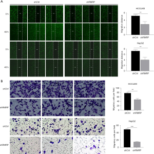 The long noncoding RNA RMRP-miR-3135a-SV2A axis promotes the