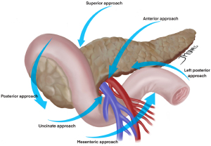 Female anterior thoracic wall chest muscles. Poster Print by Hank