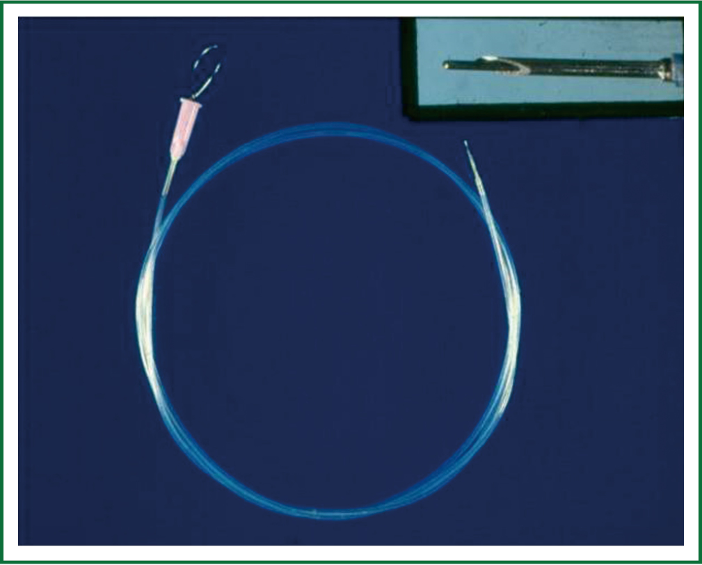 Evolution Of Transbronchial Needle Aspiration A Hybrid Method Zhang Journal Of Thoracic Disease