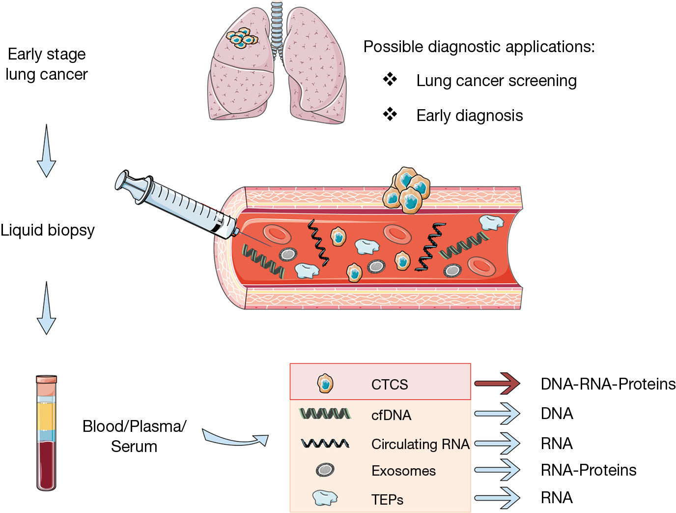 Liquid Biopsy For Lung Cancer Early Detection Santarpia Journal Of