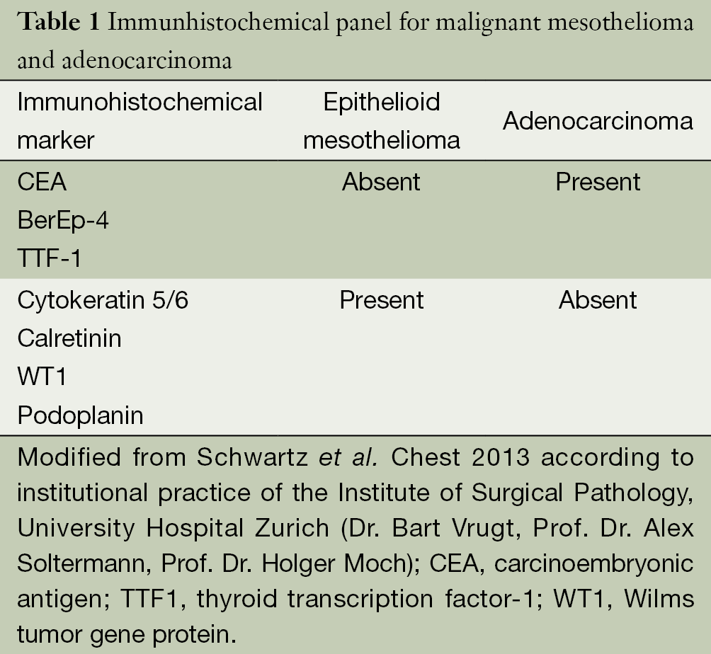 Management Of Malignant Pleural Mesothelioma The European Experience Opitz Journal Of Thoracic Disease