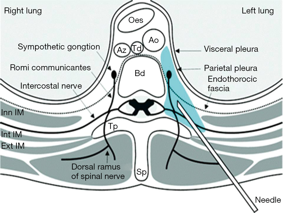 Postoperative Pain Management Kolettas Journal Of Thoracic Disease