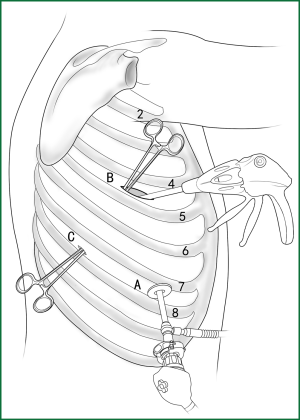 Figure 15