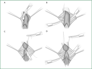 Figure 18