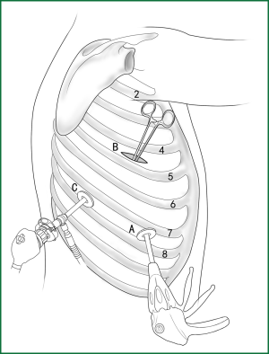 Figure 30