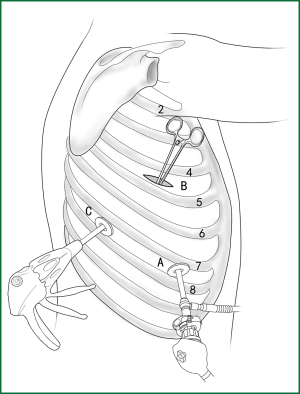 Figure 32