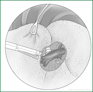 Figure 34