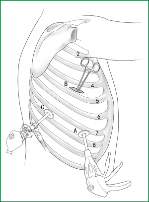 Figure 39