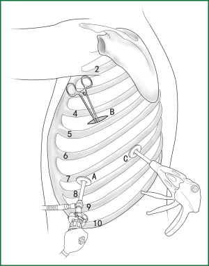 Figure 42