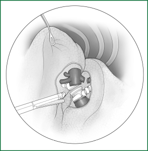 Figure 47