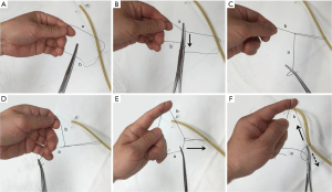Extracorporeal instrument knotting technique for minimal access