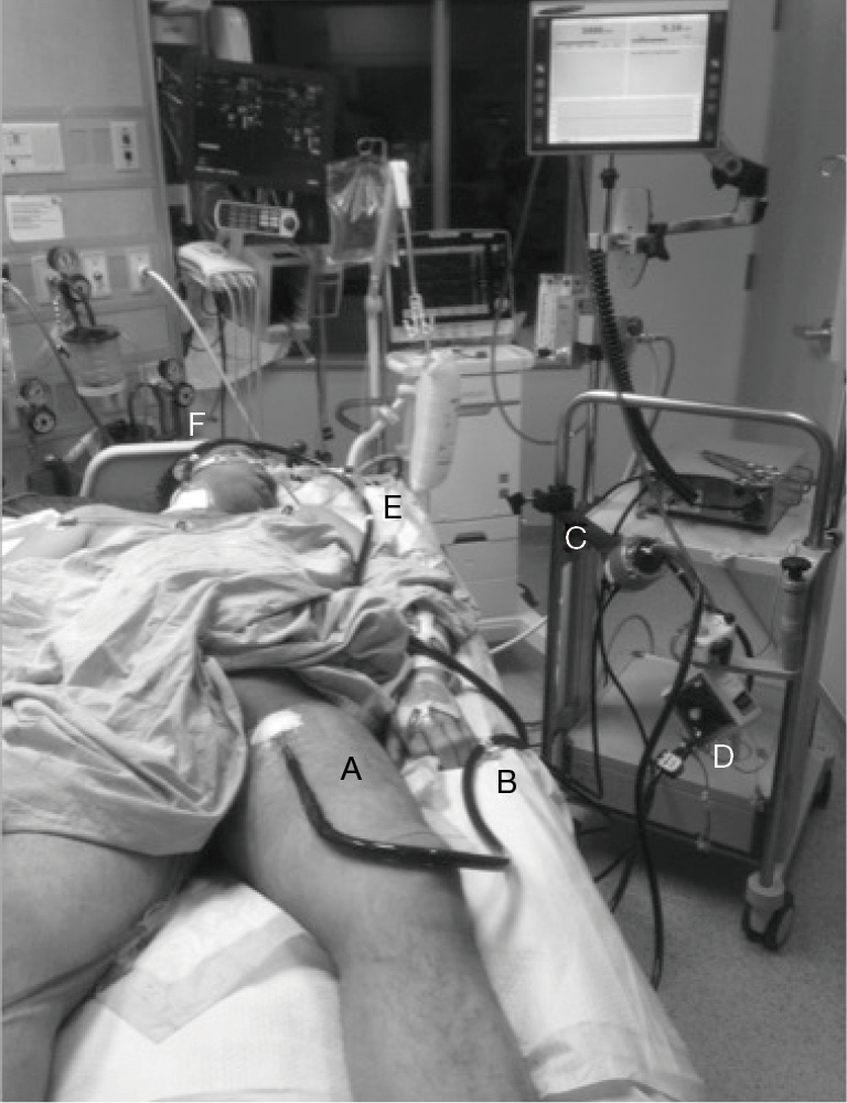 journal of thoracic disease ame publishing company