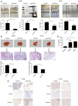 IL-6 promotes metastasis and EMT of non-small cell lung cancer cells by ...