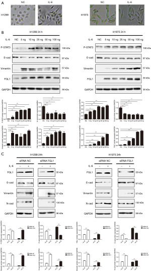 IL-6 promotes metastasis and EMT of non-small cell lung cancer cells by ...