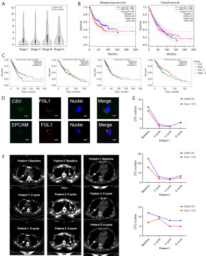 IL-6 promotes metastasis and EMT of non-small cell lung cancer cells by ...