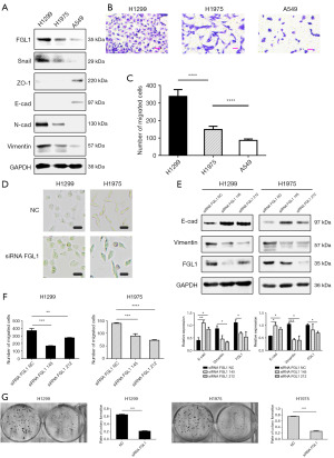 IL-6 promotes metastasis and EMT of non-small cell lung cancer cells by ...