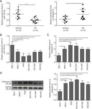 MiR-185-3p regulates epithelial mesenchymal transition via