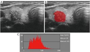 Clinical utility of histogram analysis of grayscale