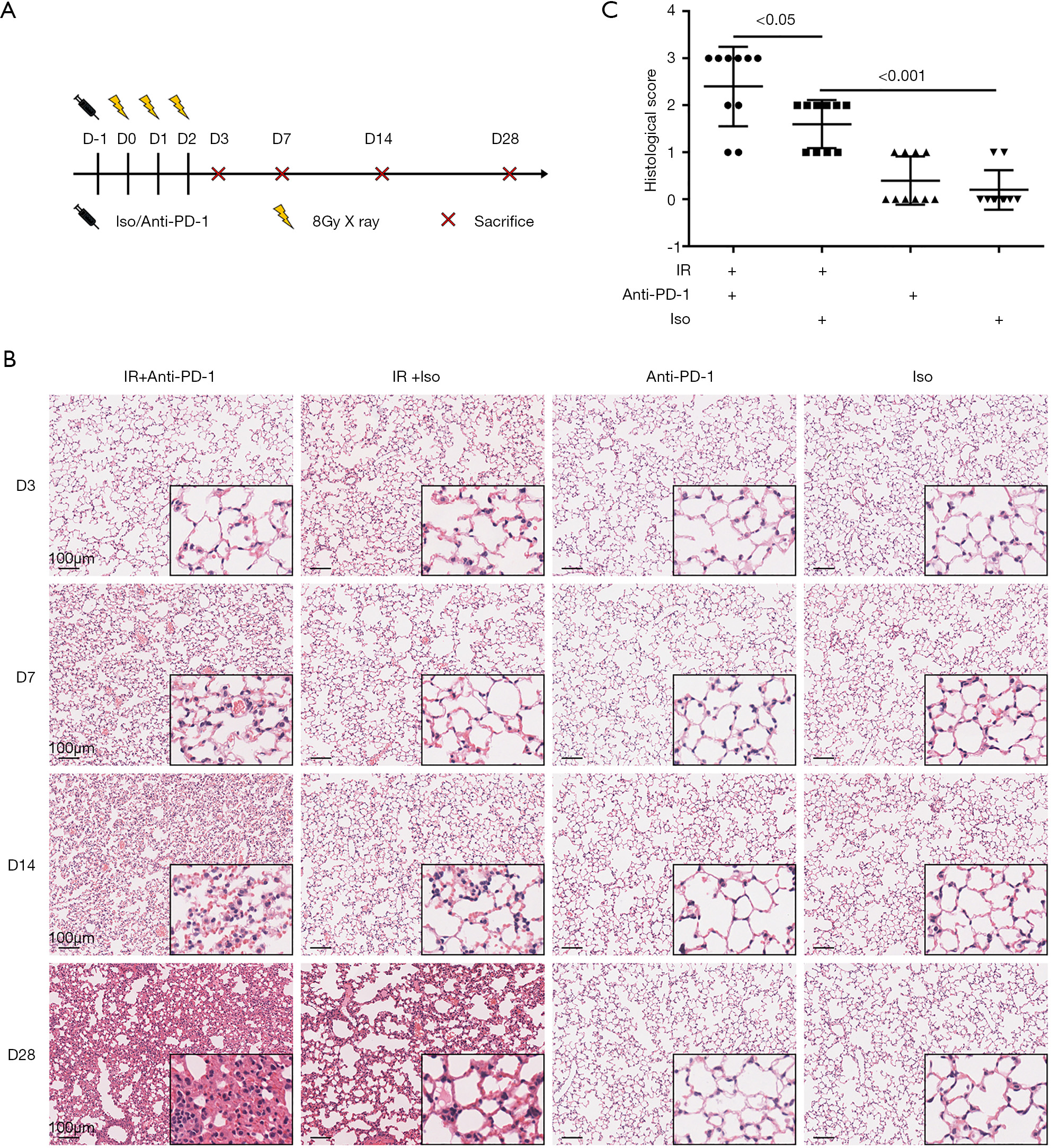 Pd 1 Restrains Il 17a Production From Gd T Cells To Modulate Acute Radiation Induced Lung Injury Sheng Translational Lung Cancer Research