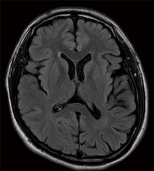 The assessment of pulsatile tinnitus—a systematic review of underlying ...