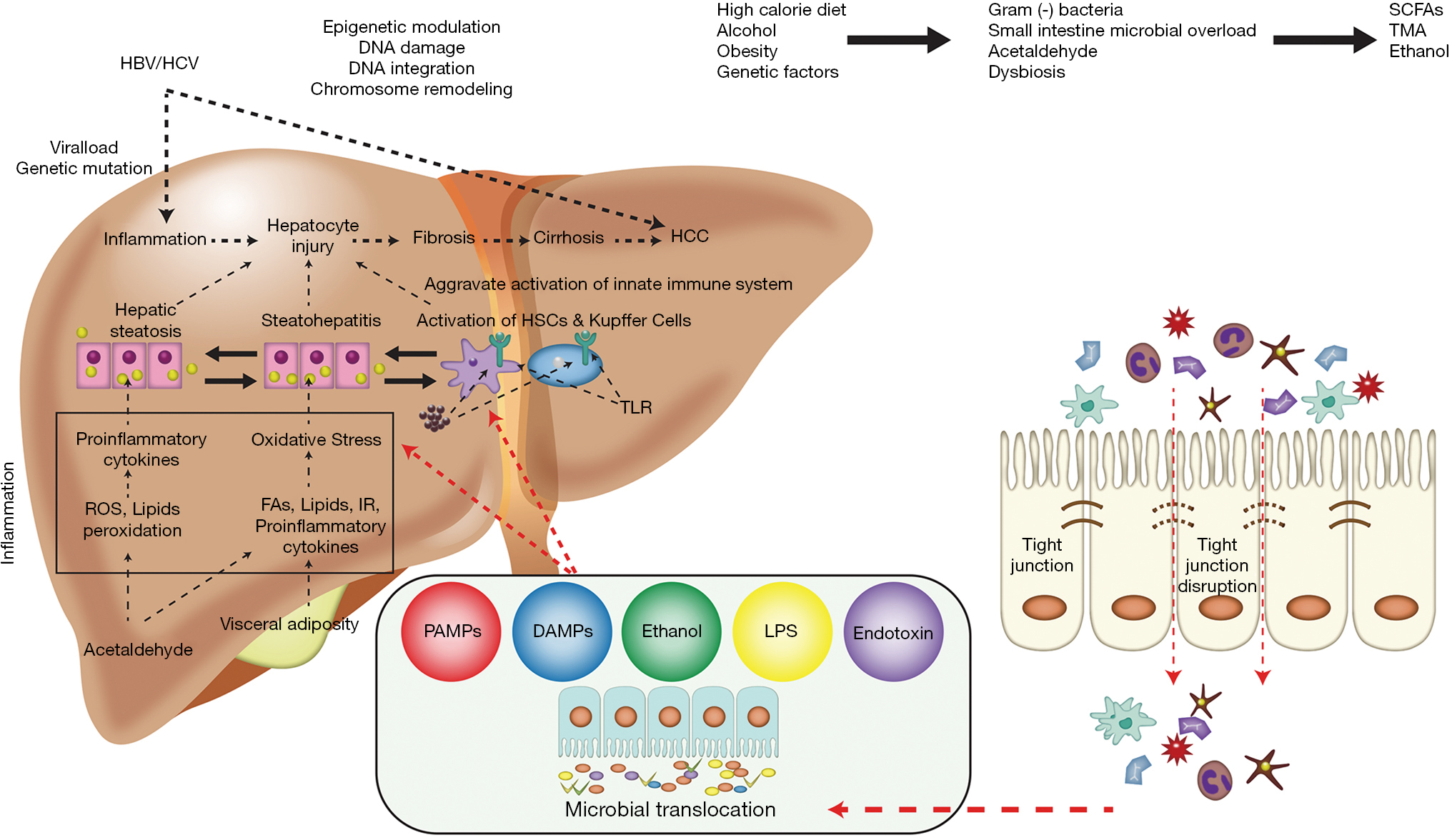 Hepatocellular carcinoma in alcoholic and non-alcoholic fatty liver
