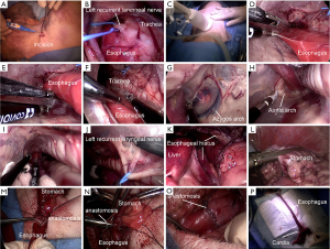 Insufflated Laparoscopic Model - PulseMDM
