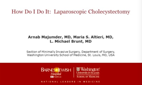 How do I do it: laparoscopic cholecystectomy