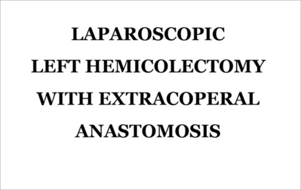 Laparoscopic left hemicolectomy with extracorporeal anastomosis surgical technique: how I do it